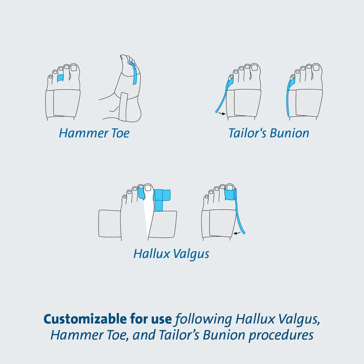 Toe Alignment Splint – Total Care